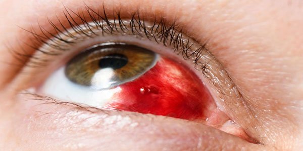 Ocular Trauma Services